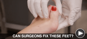 CAN SURGEONS FIX THESE FEET? FIND OUT here…